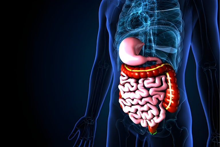 Gastro Surgery