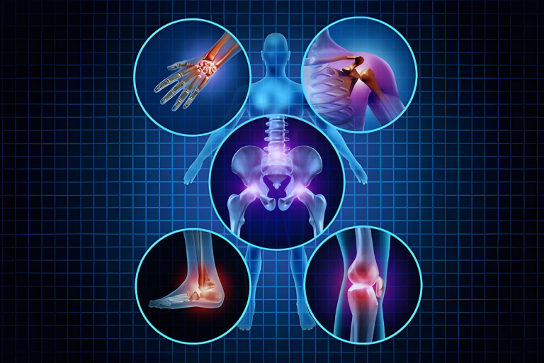 Pain Management